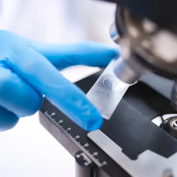 FFC Ricerca fibrosi cistica_ laboratorio provetta